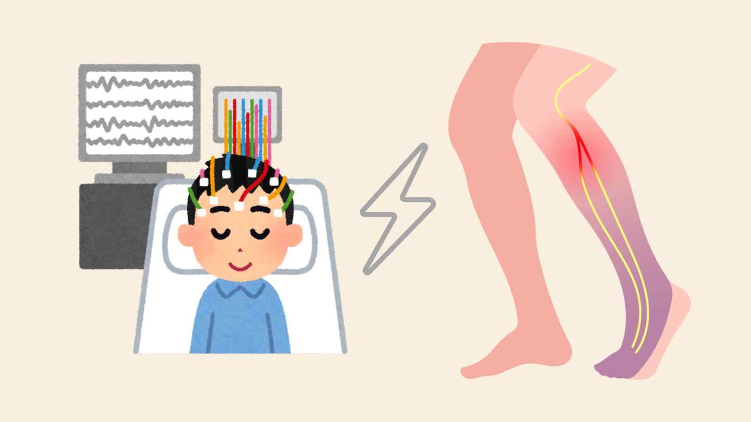 Un team di ricercatori sta testando una nuova tecnica basata sulla stimolazione cerebrale profonda, o DBS, per i pazienti con paralisi.