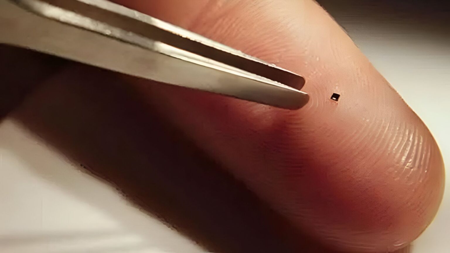 Microrobot un aiuto alla neurochirurgia