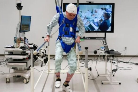 Cina: il chip che “guarisce” la paralisi e fa tornare le persone a camminare