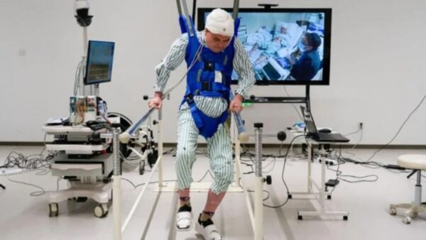 Cina: il chip che "guarisce" la paralisi e fa tornare le persone a camminare