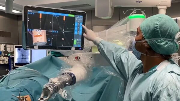Tecnologia GPS: la spalla perfetta grazie alla chirurgia innovativa