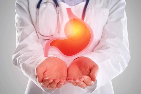 Grape di Alibaba individua il cancro allo stomaco da una TAC