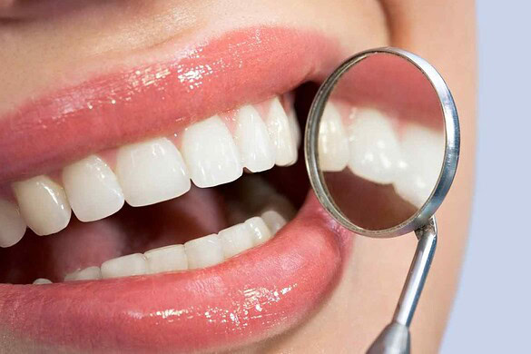 Biotech anti-carie: il gel che ricostruisce smalto naturale
