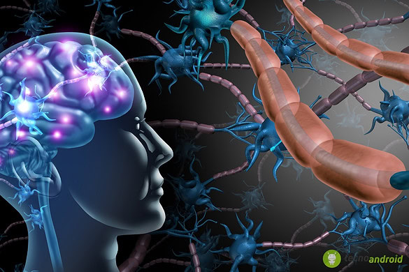 Microplastiche nel cervello aumentano il rischio di demenza vascolare
