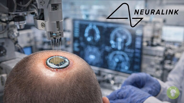 Chip nel cervello, Neuralink: produzione di massa già nel 2026