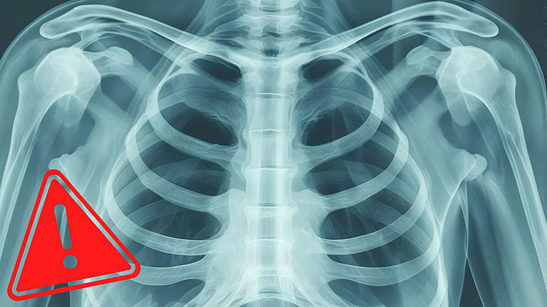 Deepfake nelle radiografie: i radiologi li riconoscono meno della metà delle volte