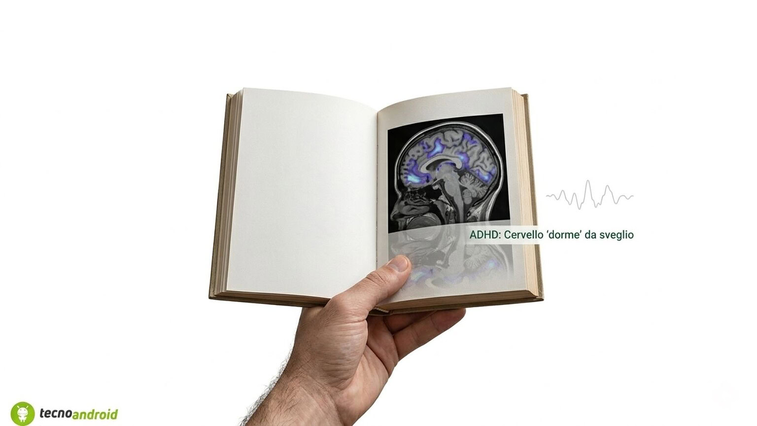 ADHD, il cervello "dorme" anche da sveglio: lo studio che cambia tutto