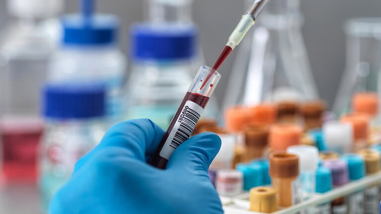 Esame del sangue predice la sopravvivenza: lo studio che cambia tutto - esame del sangue sopravvivenza