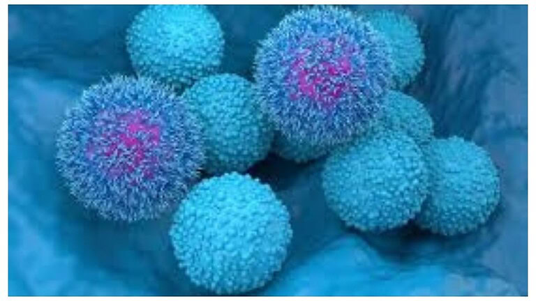 Tumore del pancreas