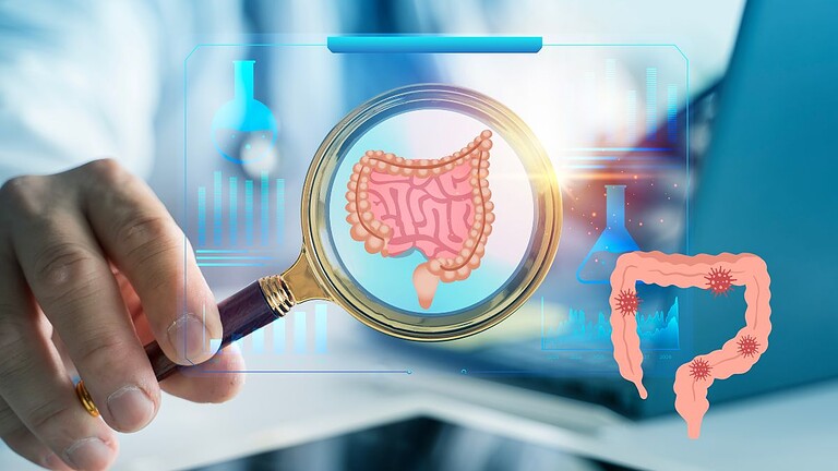 Tumore al colon rimosso in ipnosi: il primo caso al mondo è italiano