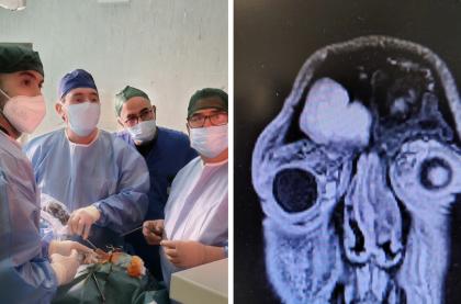 Policlinico di Bari intervento