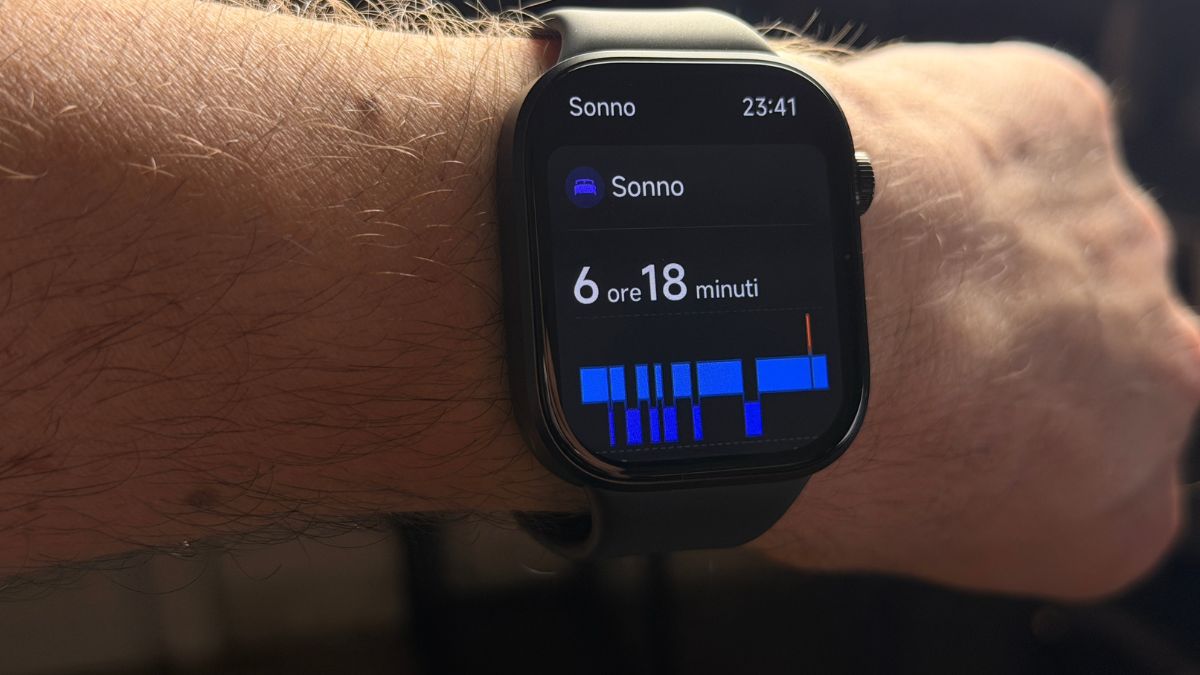 Redmi Watch 6