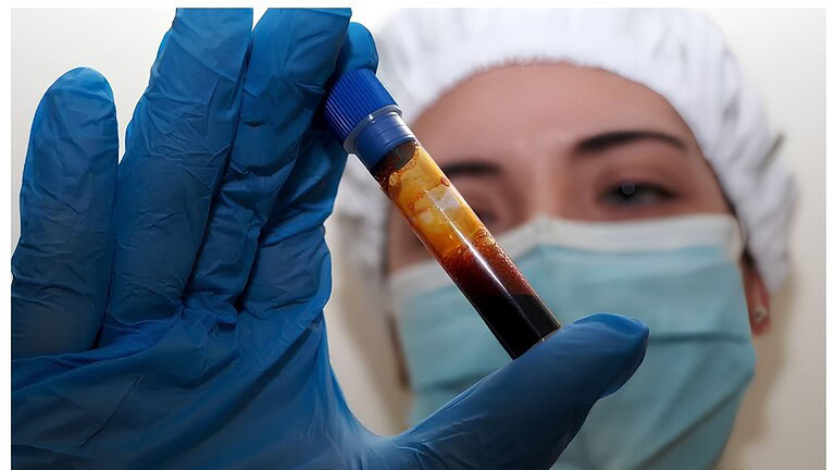 test hantavirus USA