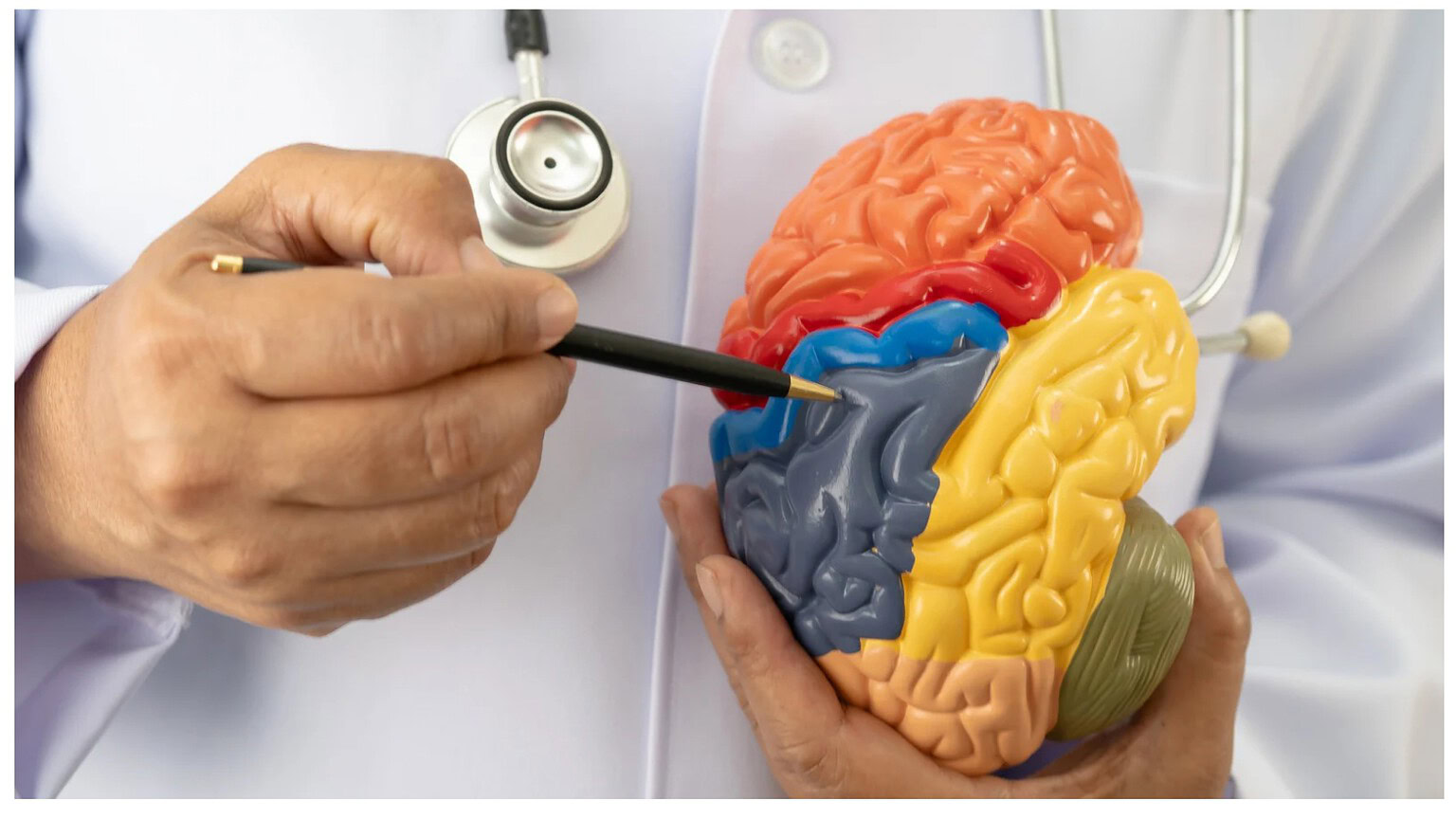 Alzheimer