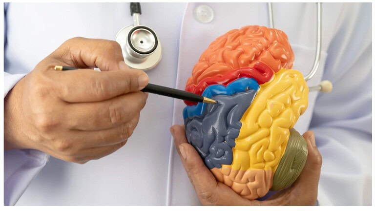 Alzheimer