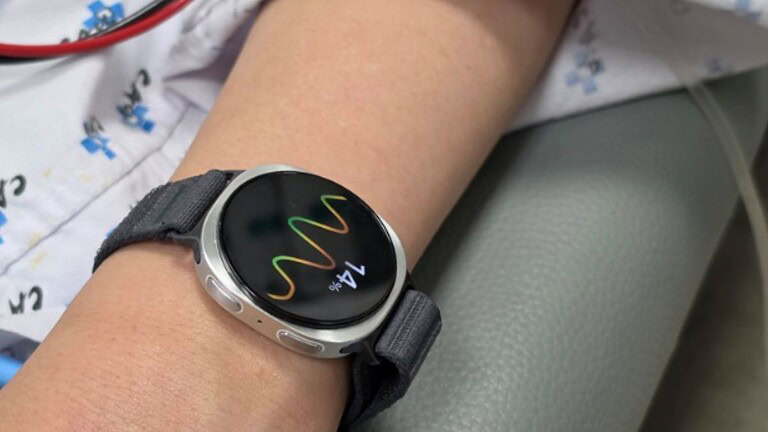 Galaxy Watch predice gli svenimenti con 5 minuti di anticipo: uno studio mondiale