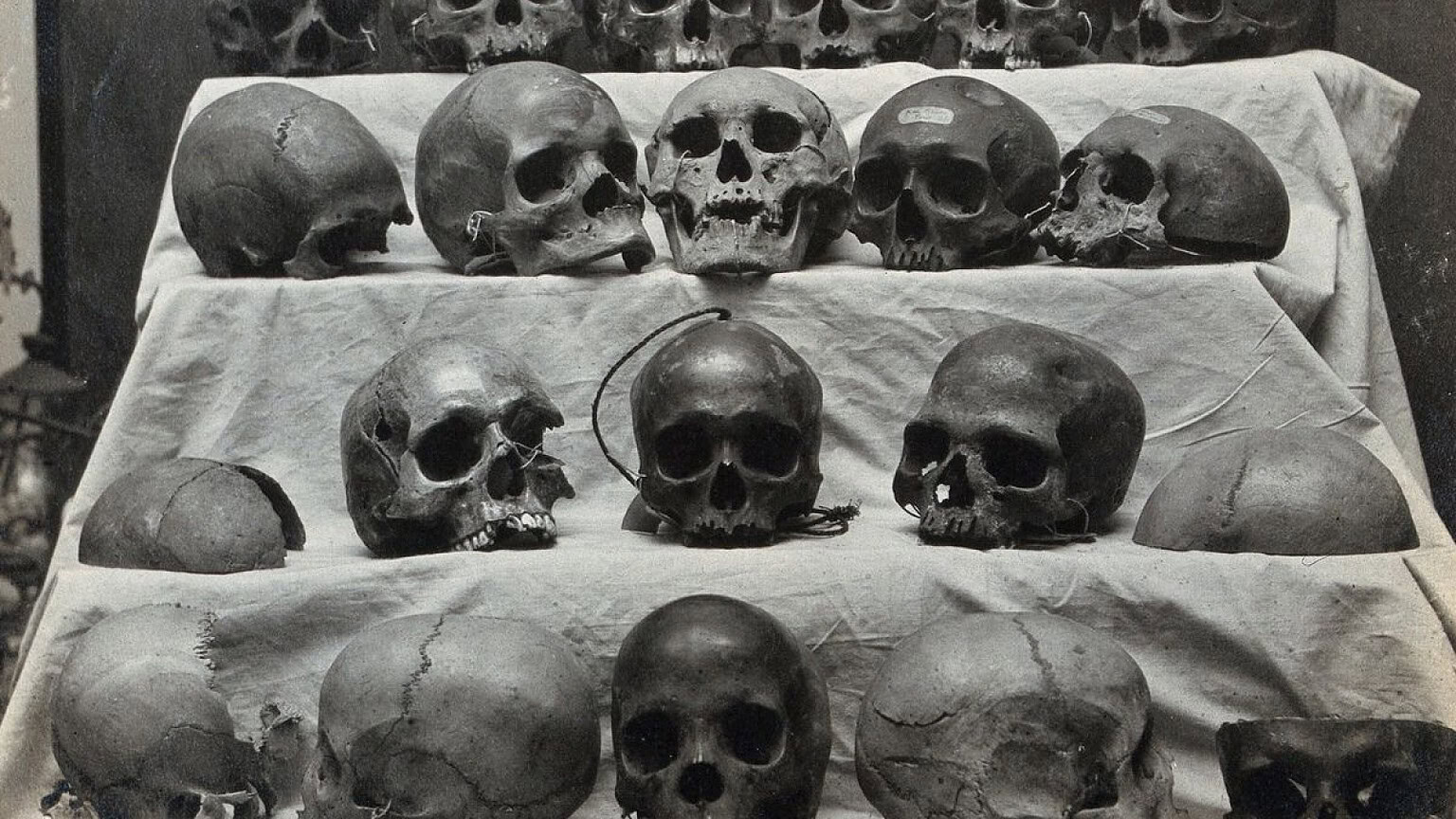 Cranio umano: è cambiato in modo incredibile in soli 100 anni - cranio umano cambiato