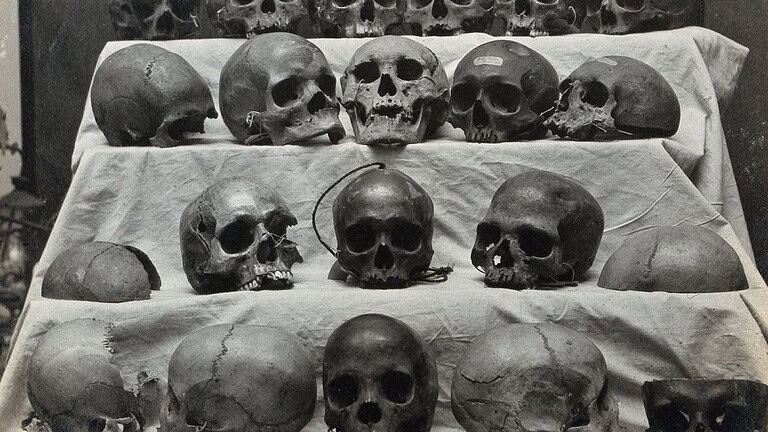 Cranio umano: è cambiato in modo incredibile in soli 100 anni - cranio umano cambiato
