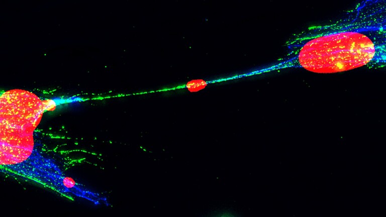 DNA danneggiato viaggia tra cellule tramite nanotubi: il legame col cancro - DNA danneggiato nanotubi