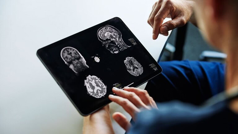 IA e diagnosi mancate: lo studio che cambia satisfies tutto Hmm, let me re-read the requirements and craft a proper title. The article is about AI helping docto