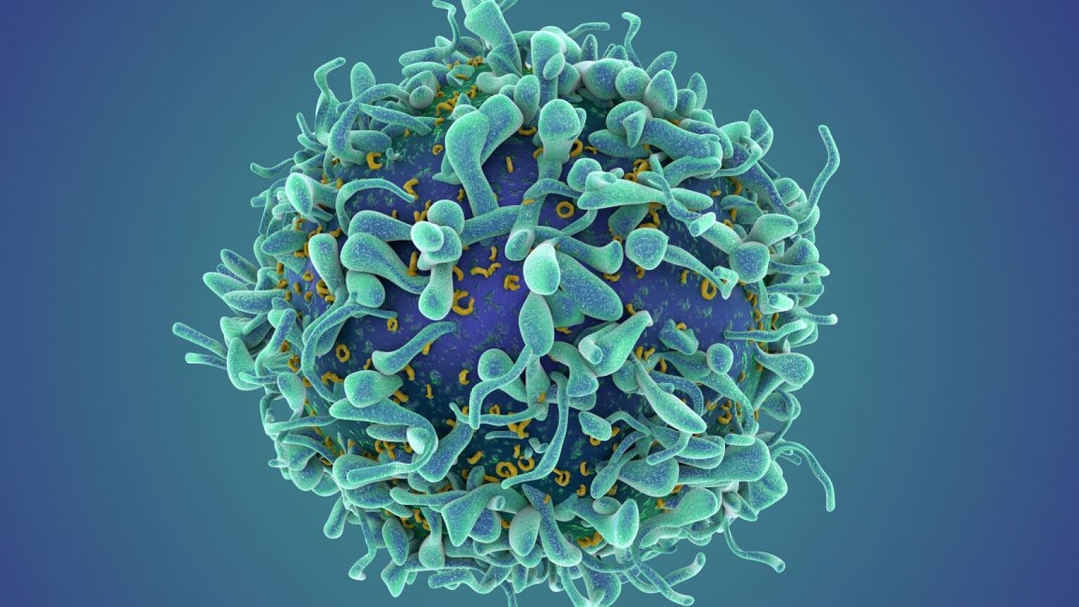 Terapia CAR T: dal cancro a una svolta per le malattie autoimmuni - terapia CAR T malattie