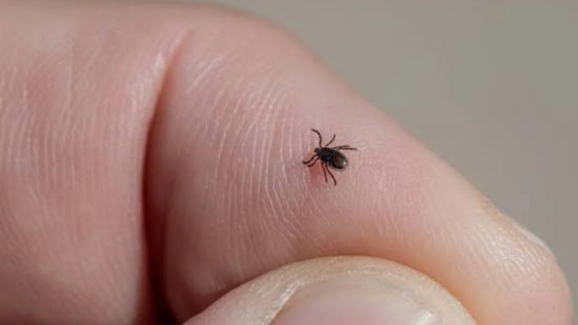 Morsi di zecca: come riconoscerli, rimuoverli e prevenire i rischi