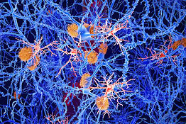 Alzheimer, una molecola naturale potrebbe riattivare le difese del cervello