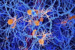 Alzheimer, una molecola naturale potrebbe riattivare le difese del cervello