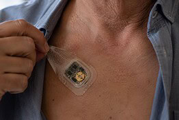 Cerotto pacemaker a ultrasuoni, ci pensa il MIT: niente operazione