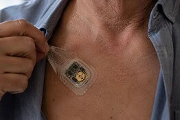 Cerotto pacemaker a ultrasuoni, ci pensa il MIT: niente operazione