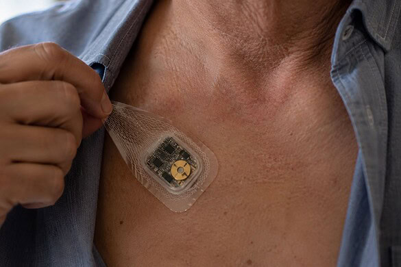 Cerotto pacemaker a ultrasuoni, ci pensa il MIT: niente operazione