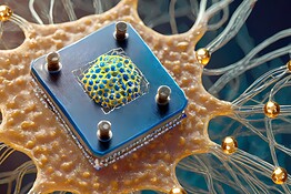 Neuralink, Samsung produrrà i chip cerebrali di Musk: il progetto O1