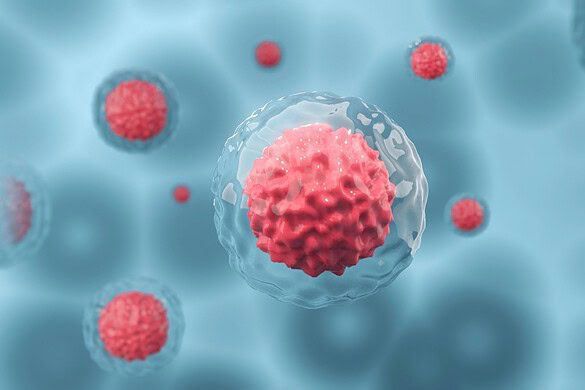 Cellule staminali, prima remissione completa di 15 anni senza farmaci