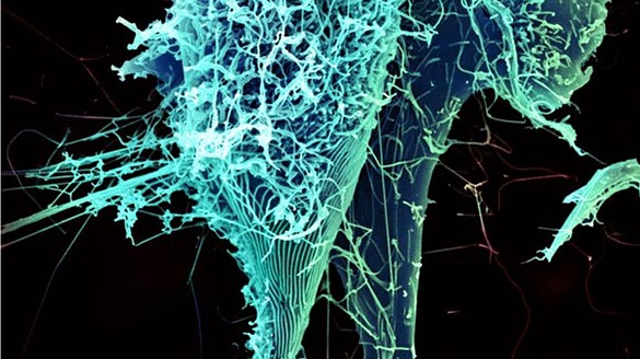 Ebola Bundibugyo, primo caso fuori dall’Africa: medico francese ricoverato