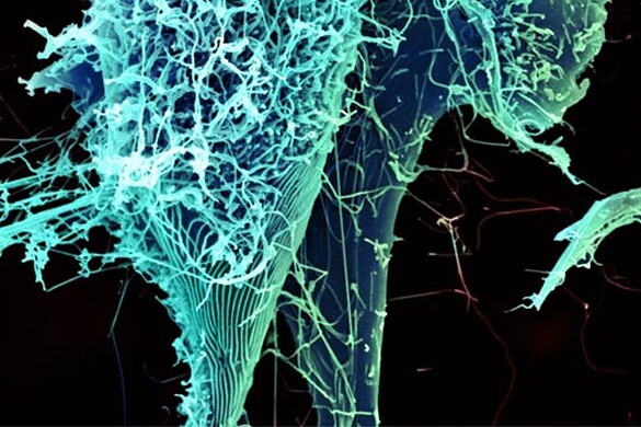 Ebola Bundibugyo, primo caso fuori dall’Africa: medico francese ricoverato