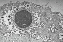 Virus giganti, la scoperta che riscrive la loro storia evolutiva