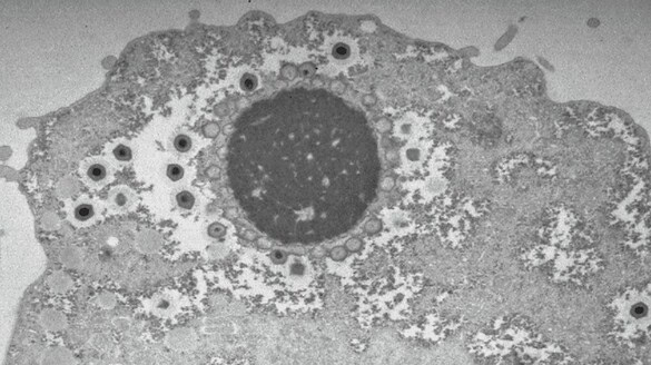 Virus giganti, la scoperta che riscrive la loro storia evolutiva