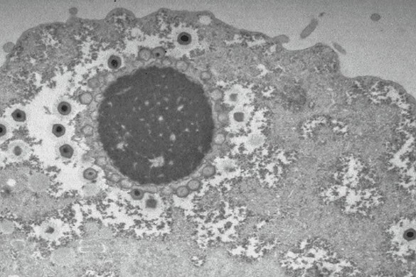 Virus giganti, la scoperta che riscrive la loro storia evolutiva
