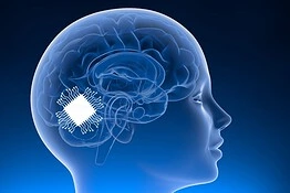 Chip nel cervello restituisce la voce ai pazienti con SLA: lo studio