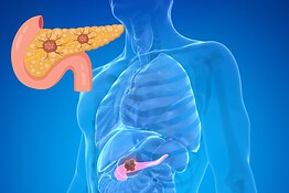 Cancro al pancreas, il farmaco che raddoppia la sopravvivenza