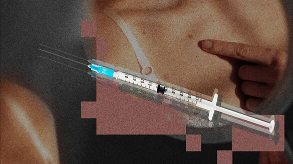 Vaccino mRNA contro il melanoma: risultati promettenti a 5 anni