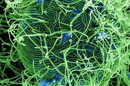 Ebola, primo vaccino contro il ceppo Bundibugyo somministrato al mondo