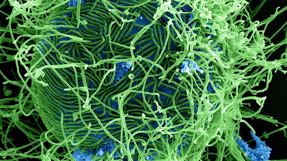 Ebola, primo vaccino contro il ceppo Bundibugyo somministrato al mondo