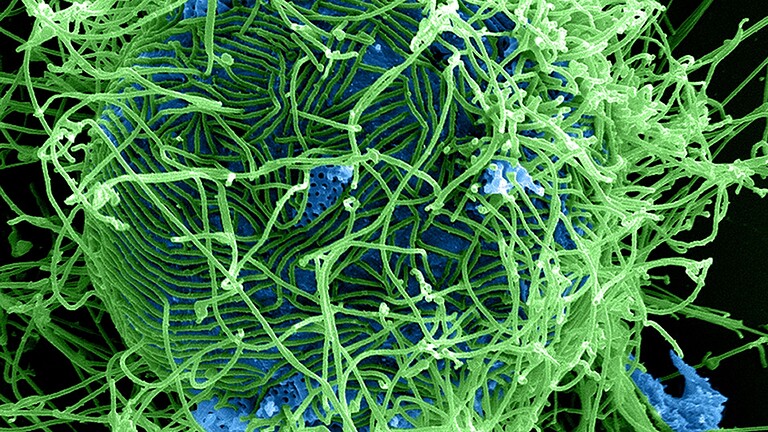 Ebola