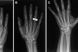 Radiografie mediche nello spazio: una svolta per gli astronauti
