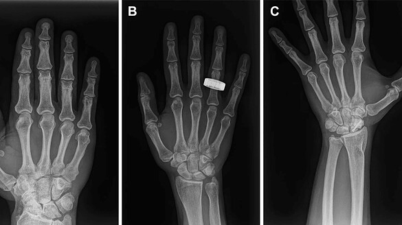 Radiografie mediche nello spazio: una svolta per gli astronauti