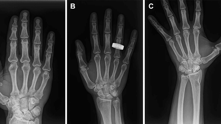 Radiografie mediche nello spazio