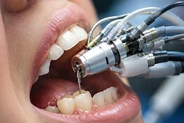 Robot dentale MIR: la corona in una sola visita dal dentista
