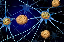 Alzheimer, scoperta la cariptosi: nuova via per fermare la morte dei neuroni