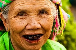 Denti neri, l’antico segreto di bellezza che sfida i millenni